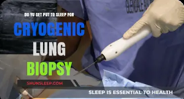 Cryogenic Lung Biopsy: Understanding Anesthesia and the Procedure