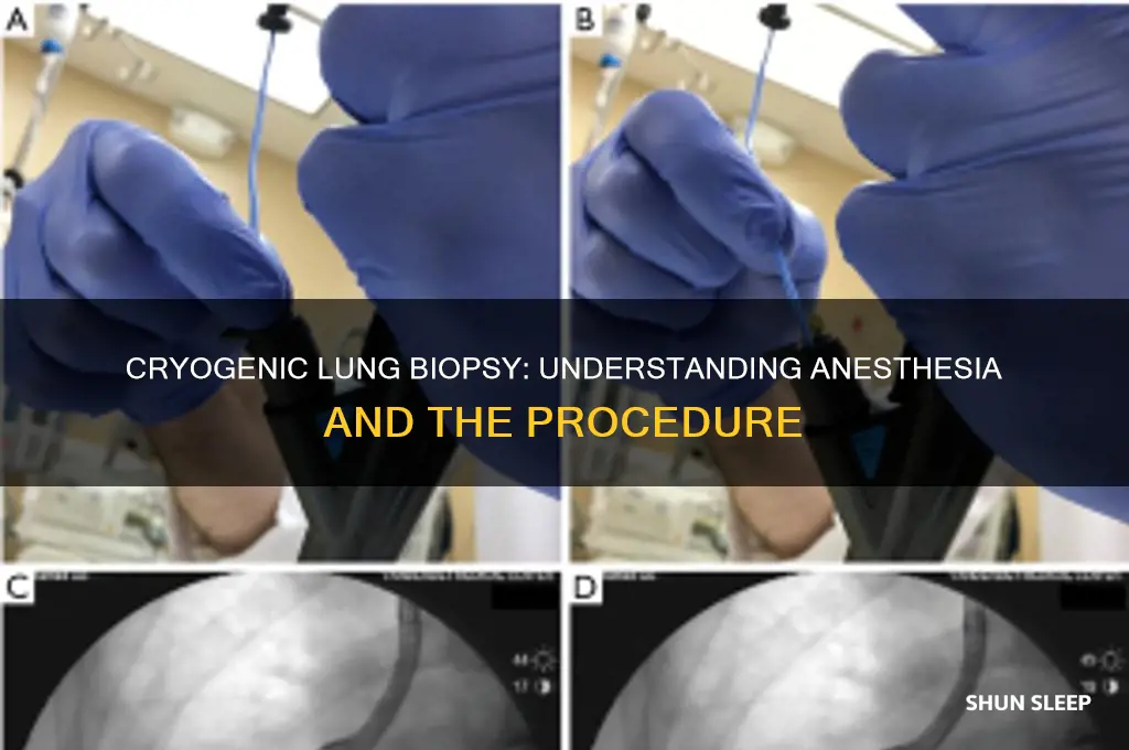 do yu get put to sleep for cryogenic lung biopsy
