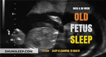 Fetal Sleep: 20-Week Development and Patterns