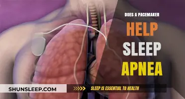 Can a Pacemaker Improve Sleep Apnea Symptoms? Exploring the Connection