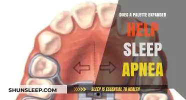 Can a Palate Expander Improve Sleep Apnea Symptoms? Exploring the Link