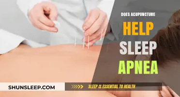 Acupuncture for Sleep Apnea: Effective Treatment or Alternative Therapy?