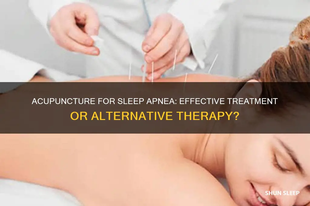 does acupuncture help sleep apnea