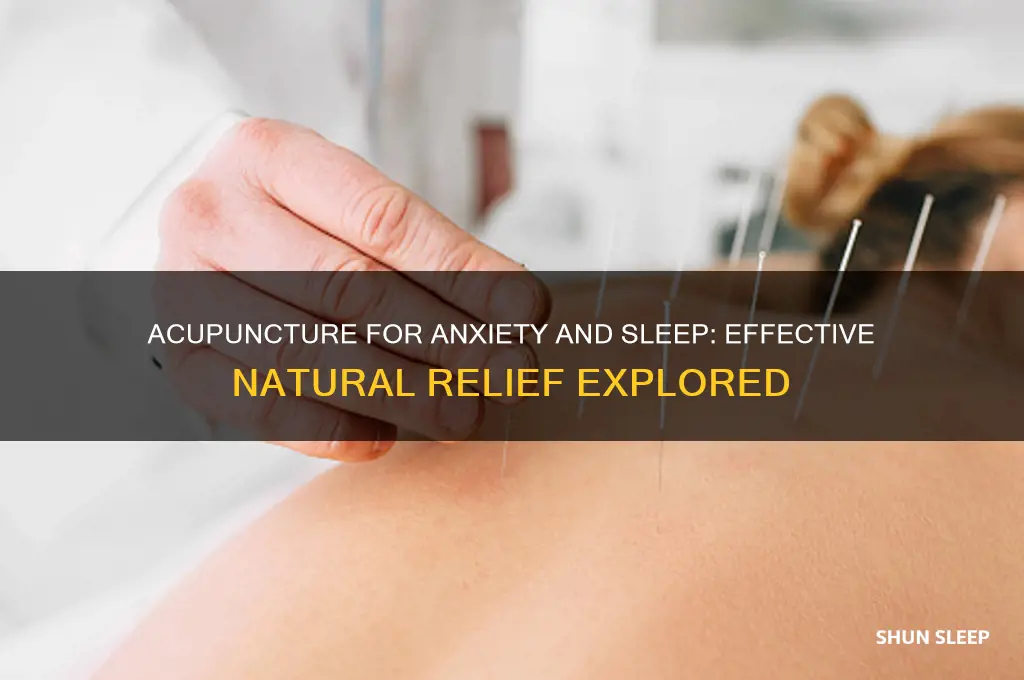does acupuncture help with anxiety and sleep
