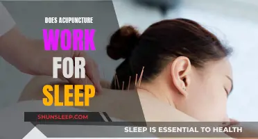 Acupuncture for Sleep: Does the Ancient Practice Work?