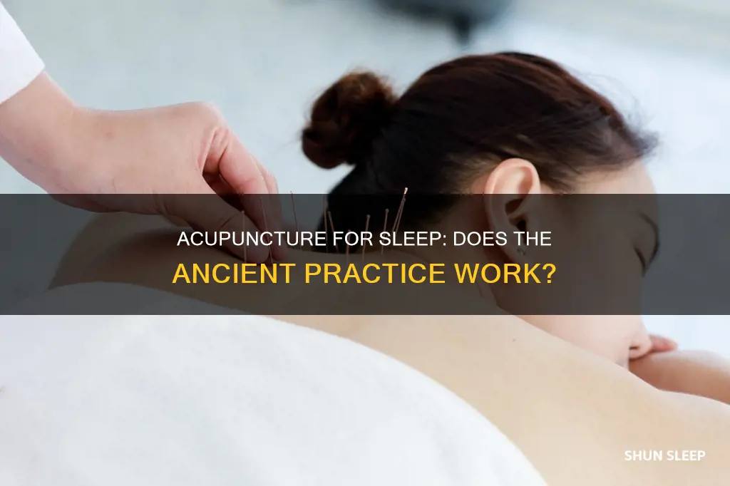 does acupuncture work for sleep