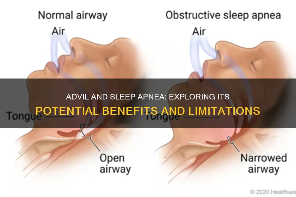 does advil help sleep apnea