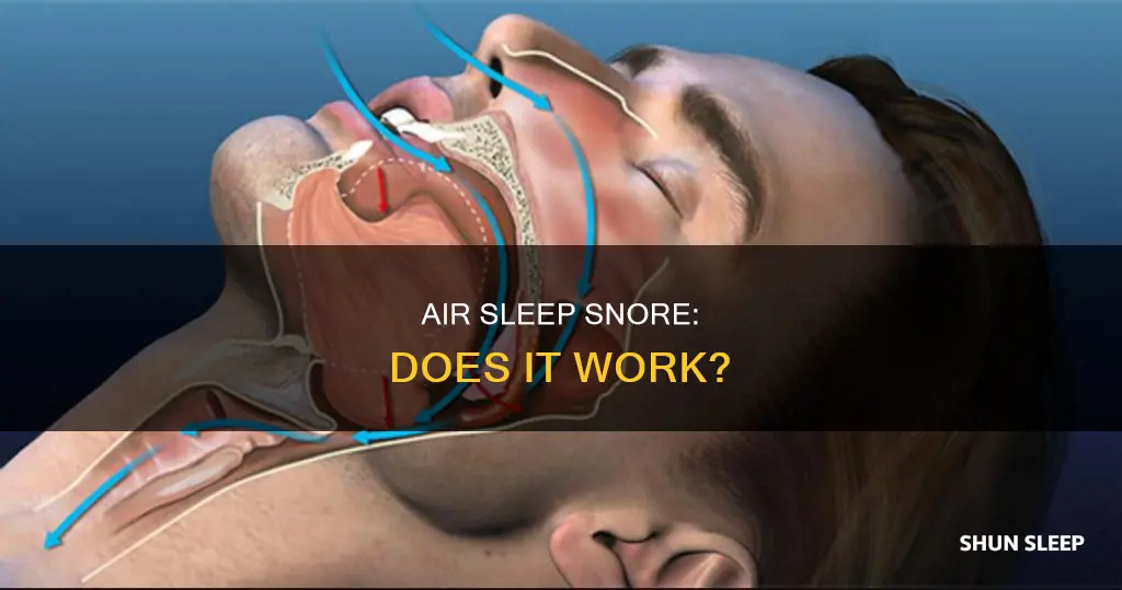 does air sleep snore work