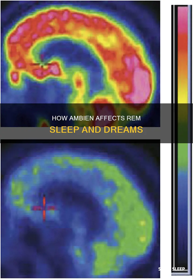 does ambien allow rem sleep