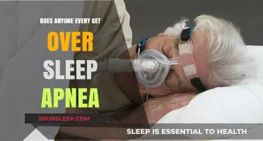 Overcoming Sleep Apnea: Can You Ever Truly Get Over It?
