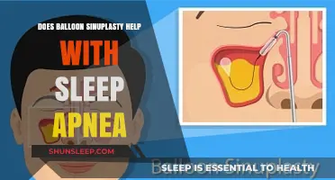 Balloon Sinuplasty and Sleep Apnea: Exploring the Connection for Better Sleep