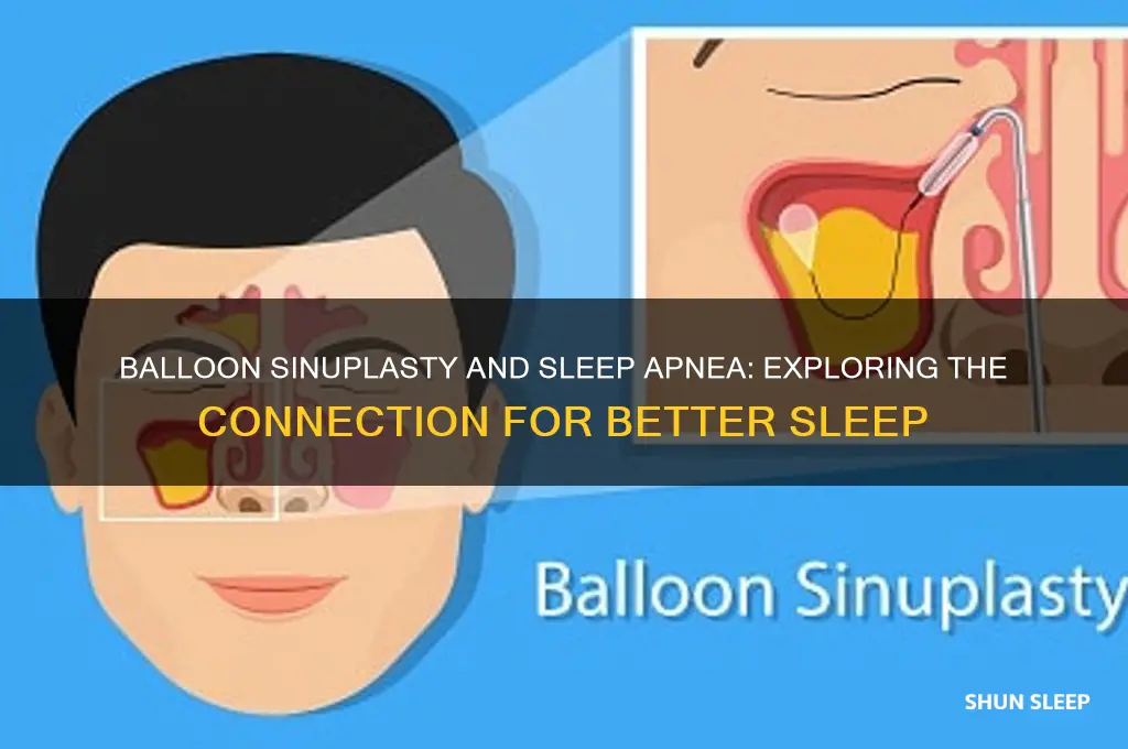 does balloon sinuplasty help with sleep apnea
