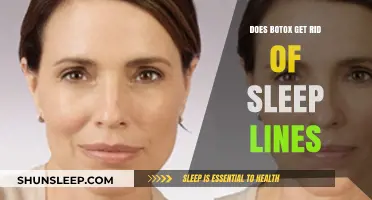 Botox for Sleep Lines: Effective Solution or Temporary Fix?