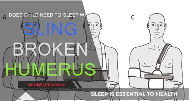 Sling Care: Sleep Solutions for Children with Broken Humerus