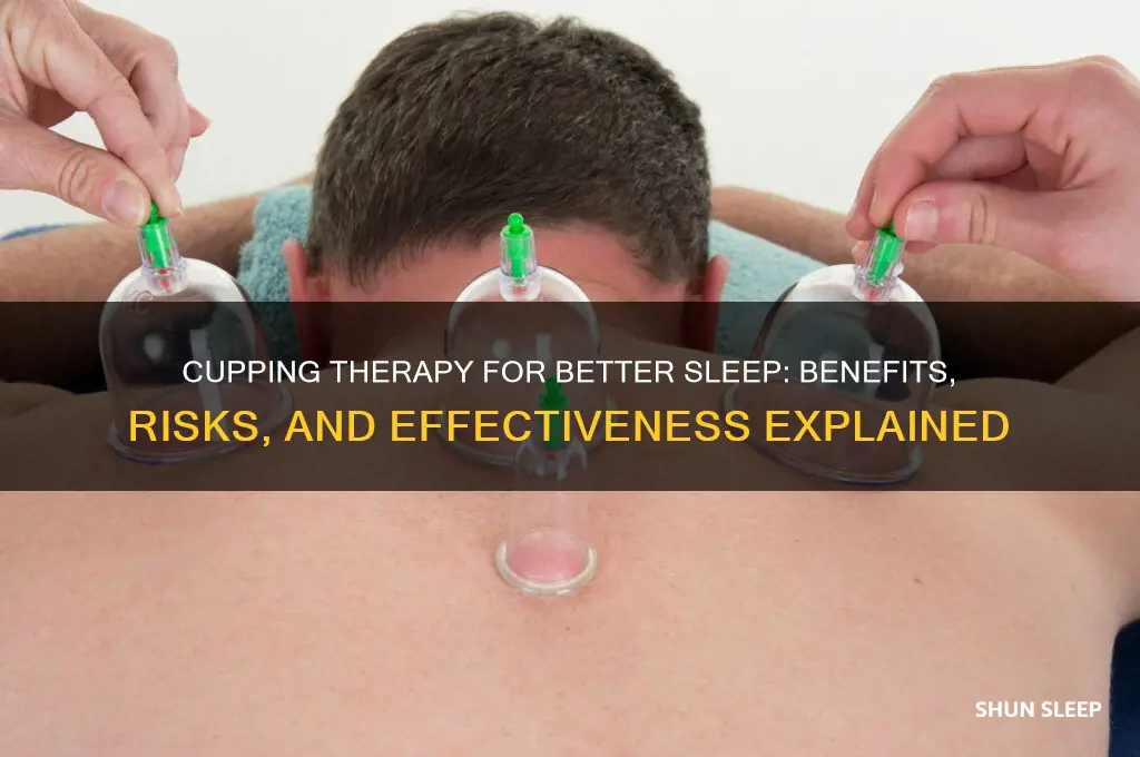 does cupping help with sleep