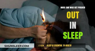 Ear Wax Movement During Sleep: Fact or Fiction?