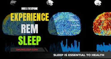 REM Sleep: A Universal Stage of Sleep?