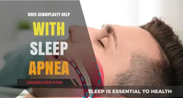 Genioplasty and Sleep Apnea: Can Jaw Surgery Improve Breathing?