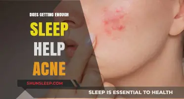 Sleep and Skin: How Rest Impacts Acne and Complexion Health