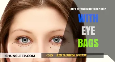 Can Extra Sleep Reduce Eye Bags? Uncovering the Truth