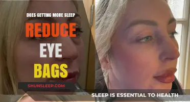 Can Extra Sleep Really Help Reduce Under-Eye Bags? Find Out