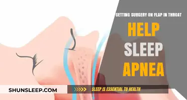 Can Throat Surgery for Flap Issues Cure Sleep Apnea? Find Out