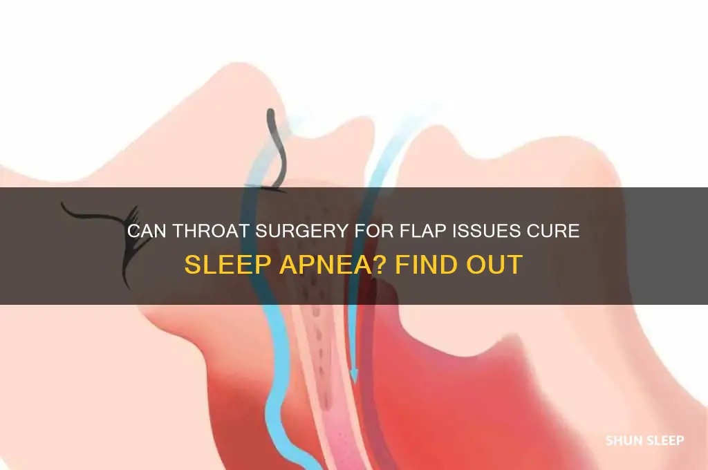 does getting surgery on flap in throat help sleep apnea