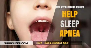 Tonsillectomy and Sleep Apnea: Can Removing Tonsils Improve Breathing?