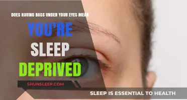 Eye Bags: Sleep Deprivation or Something More?