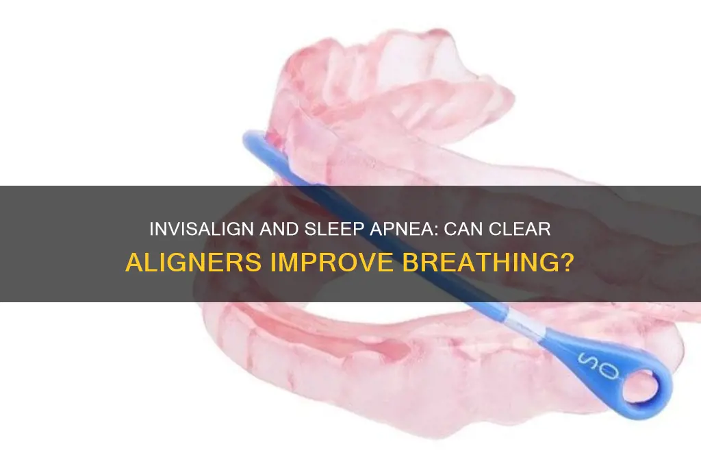 does invisalign help with sleep apnea