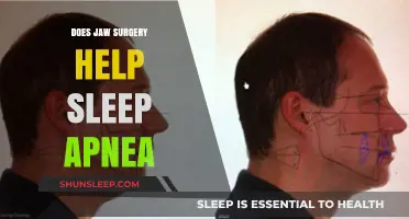 Jaw Surgery for Sleep Apnea: Effective Treatment or Last Resort?