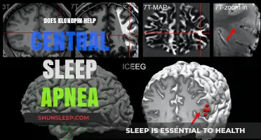 Klonopin and Central Sleep Apnea: Exploring Its Potential Benefits