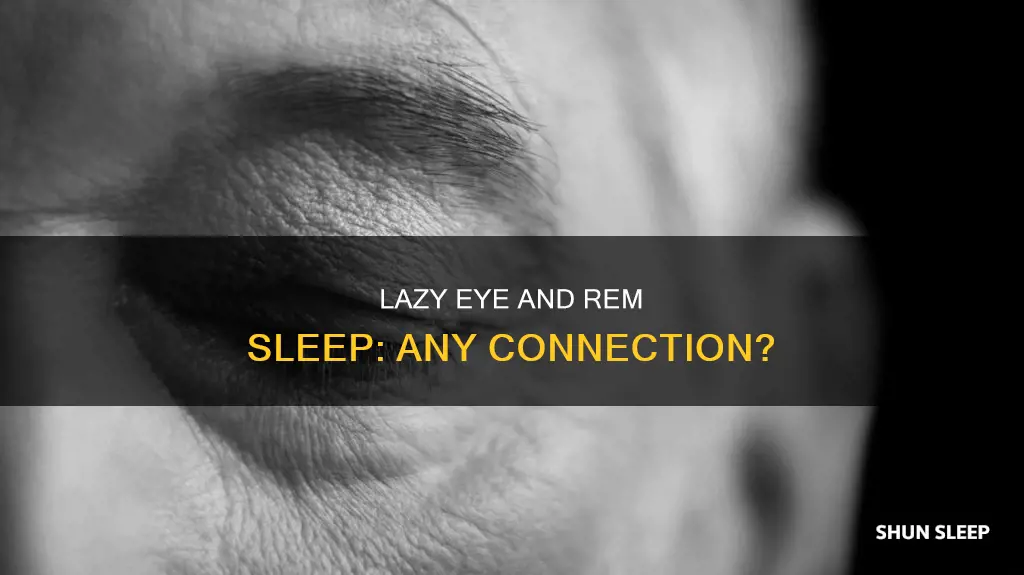 does lazy eye prevent rem sleep