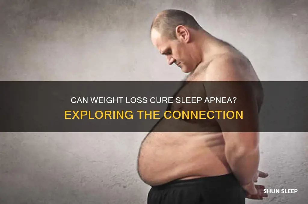 does losing weight get rid of sleep apnea