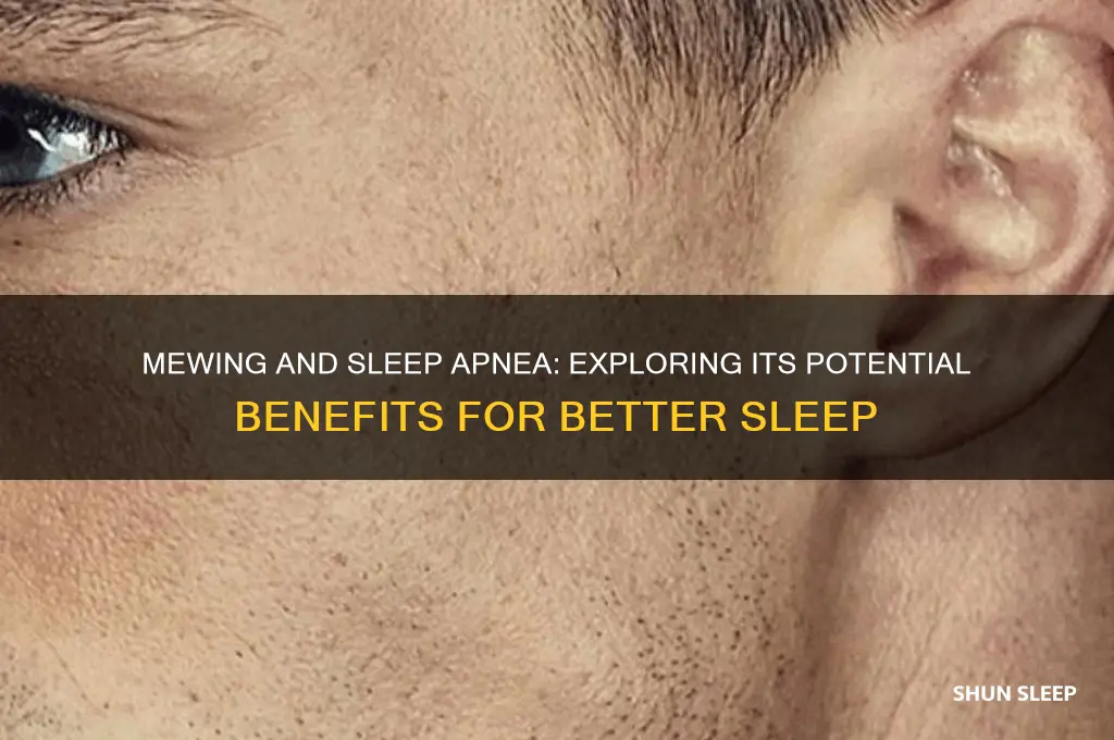 does mewing help sleep apnea