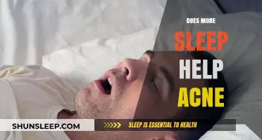 Sleep and Skin Health: Can More Rest Clear Up Acne?