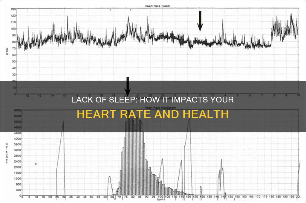 does not getting enough sleep affects your heat beat