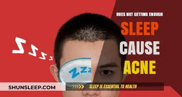 Lack of Sleep and Acne: Uncovering the Surprising Skin Connection