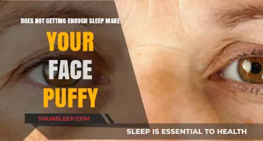 Sleep Deprivation and Facial Puffiness: Uncovering the Surprising Connection