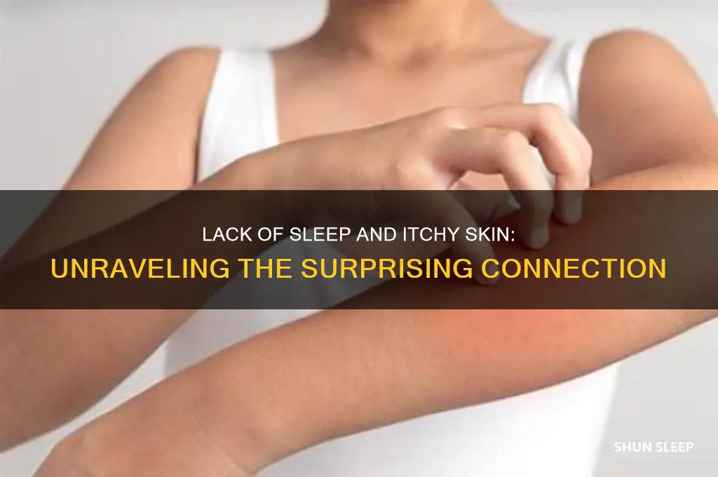 does not getting enough sleep makw you itchy