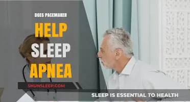 Pacemakers and Sleep Apnea: Exploring the Potential Connection for Better Sleep