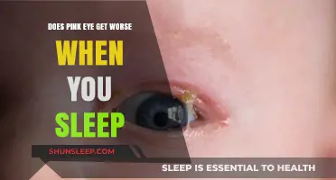 Does Pink Eye Worsen Overnight? Understanding Sleep's Impact on Conjunctivitis