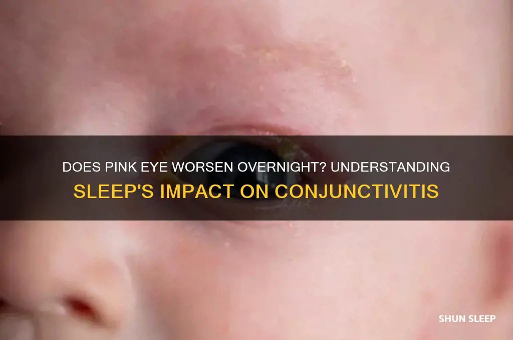 does pink eye get worse when you sleep