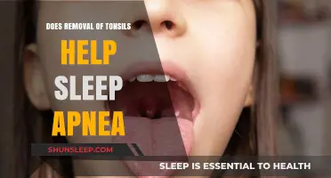 Tonsillectomy and Sleep Apnea: Can Removing Tonsils Improve Breathing?