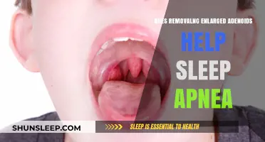 Can Removing Enlarged Adenoids Improve Sleep Apnea Symptoms?