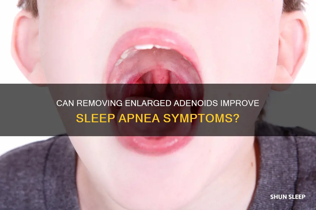 does removalng enlarged adenoids help sleep apnea