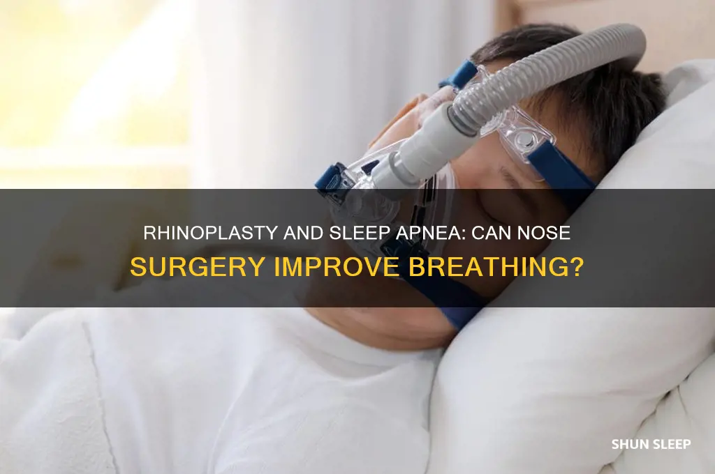does rhinoplasty help with sleep apnea