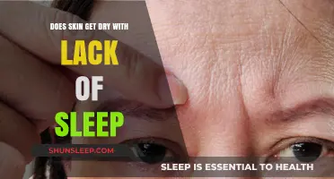 Sleep Deprivation and Skin Health: Uncovering the Link to Dryness