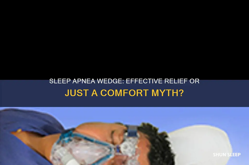 does sleep apnea wedge help