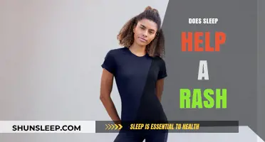 Sleep and Skin Health: Can Resting Aid Rash Recovery?